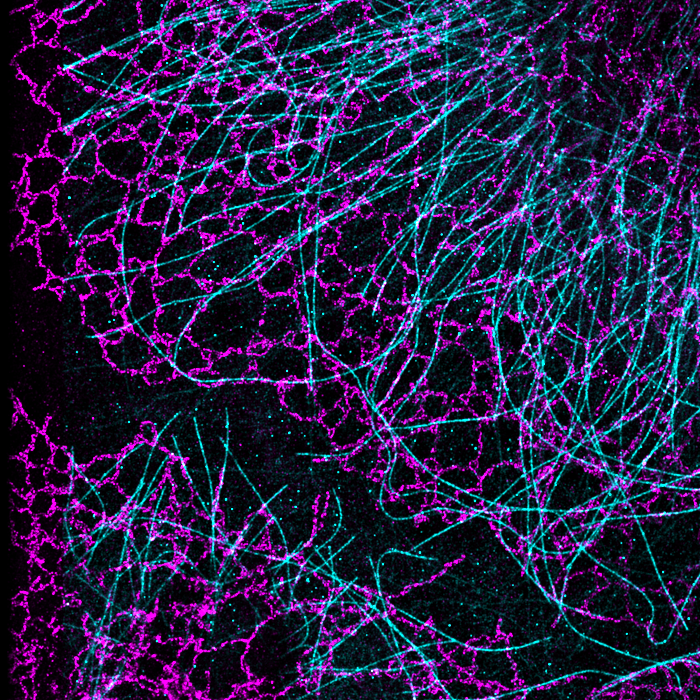 Tubulin and ER in COS7 cells