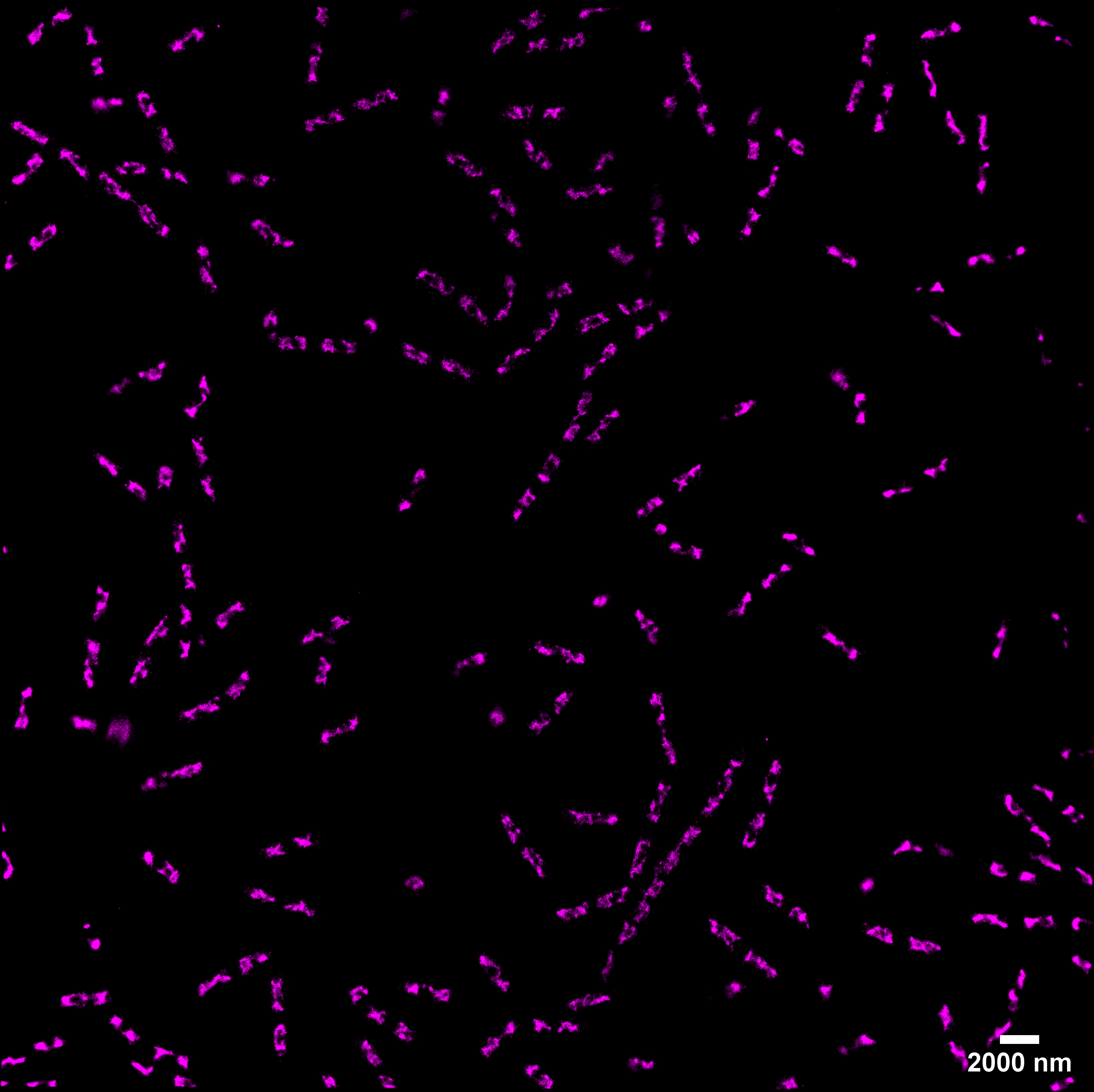 E. coli  Membrane and Chromosome