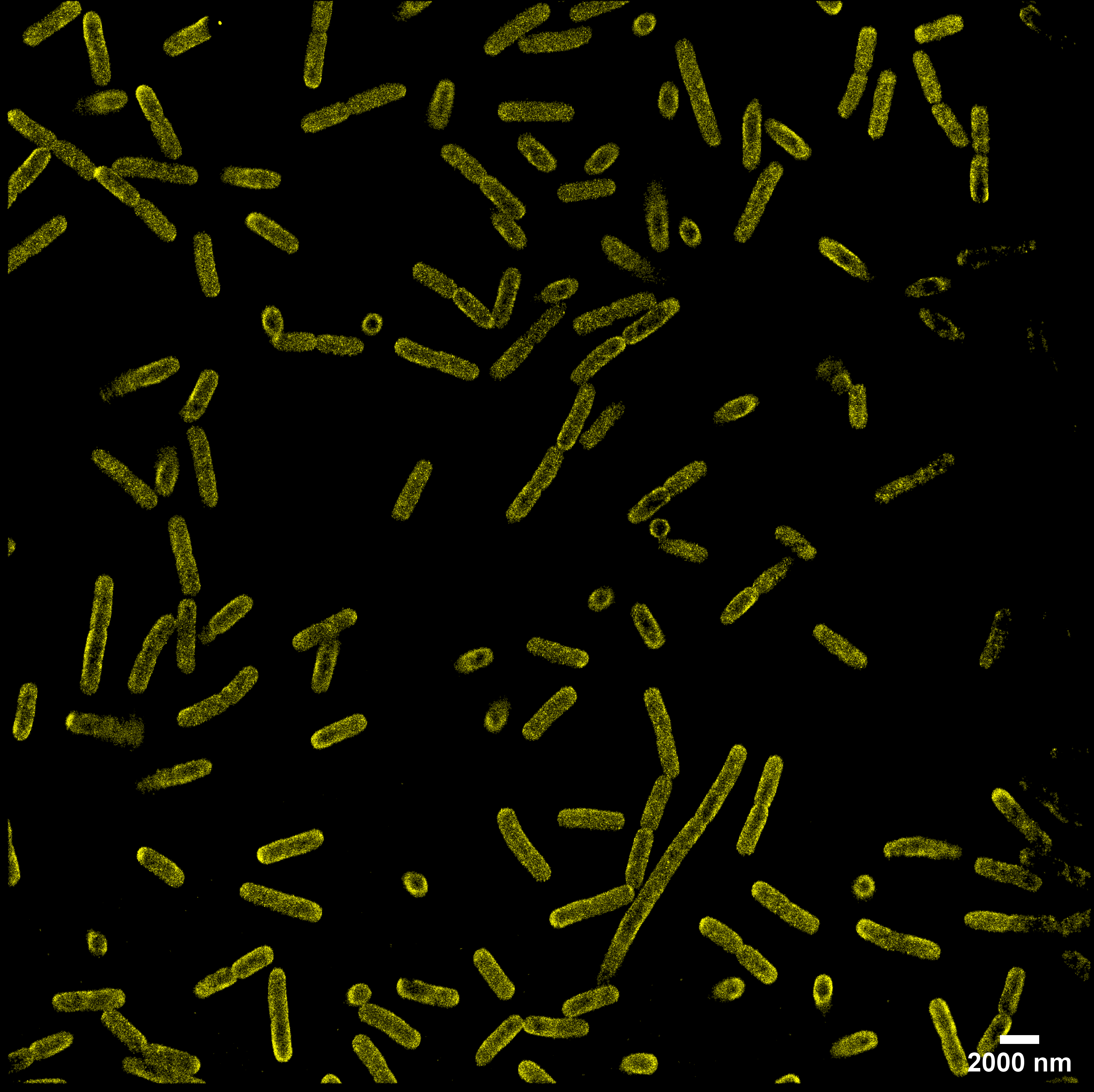 E. coli  Membrane and Chromosome