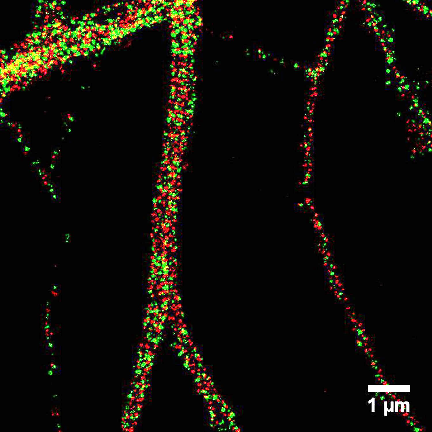 Spectrin and Adducin in neurons