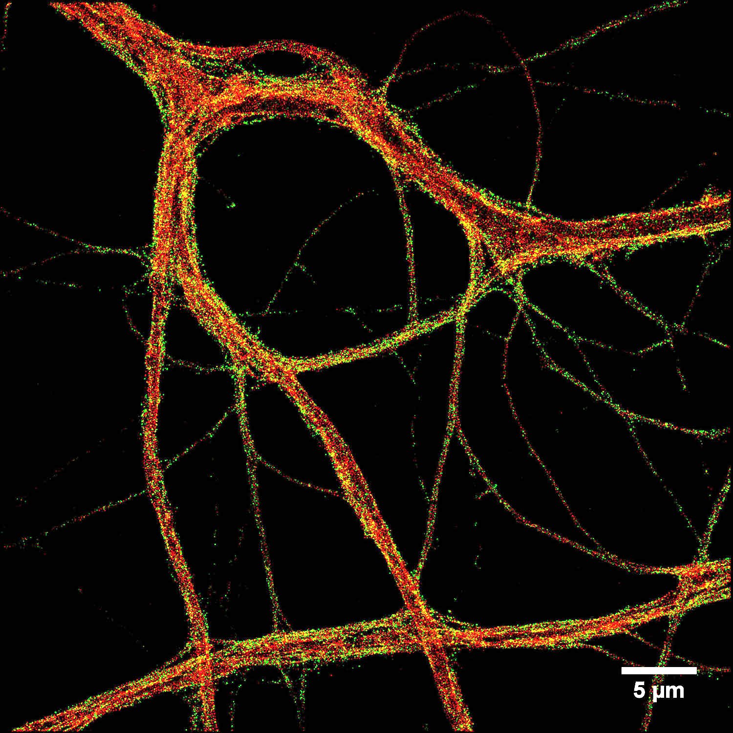 Spectrin and Adducin in neurons